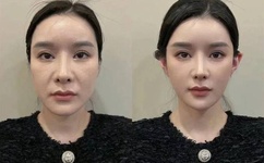 郭mini不雅视频事件